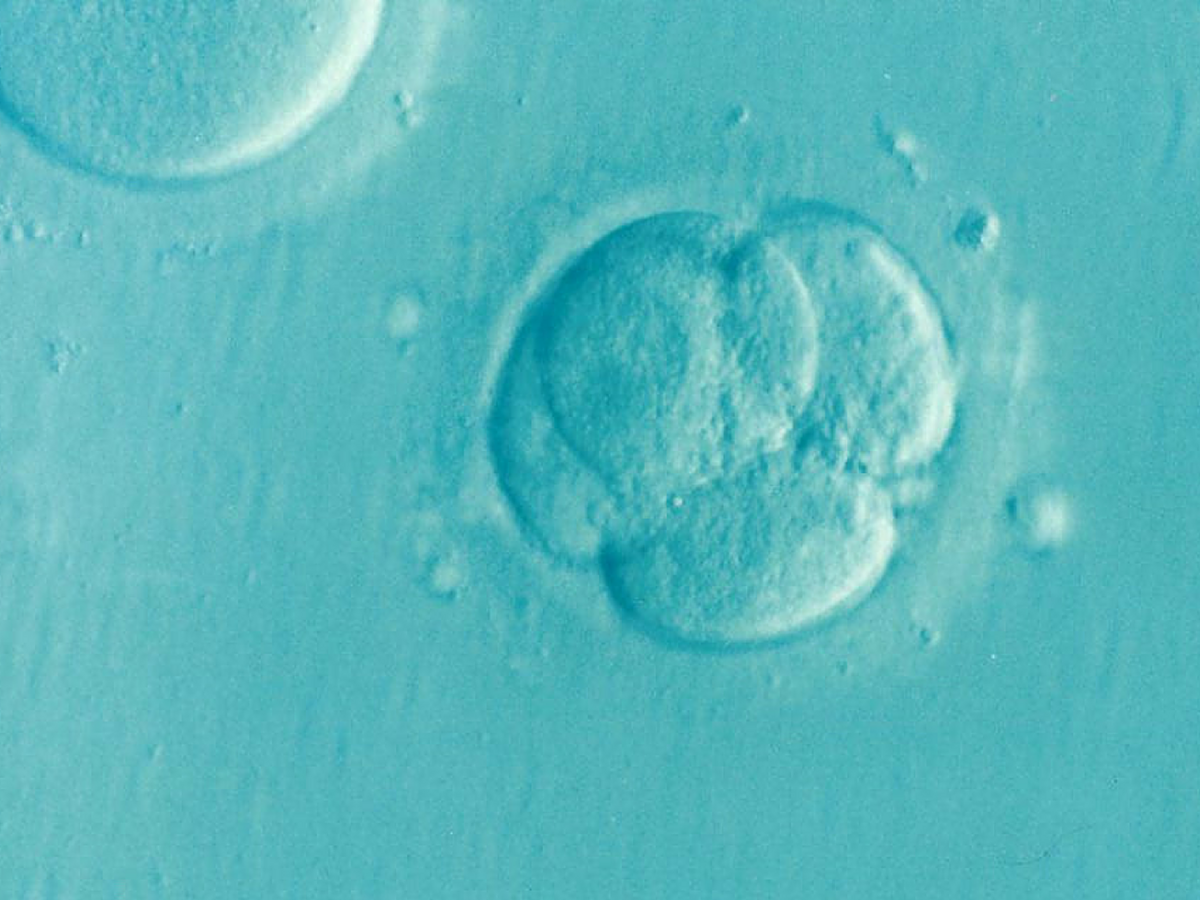 Embryo im Zellstadium. (Foto: gem)